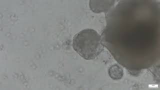 Beating organoid derived from human stem cells [upl. by Millford60]