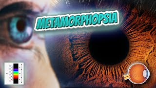 Metamorphopsia  Your EYEBALLS  EYNTK 👁️👁️💉😳💊🔊💯✅ [upl. by Ahsaya]