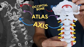 Atlantoaxial and Atlantooccipital Joints  C1 amp C2 Atlas and Axis  Radiology Anatomy Part 1  CT [upl. by Chadabe368]