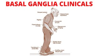 The Basal Ganglia Clinical Anatomy  Parkinson’s Disease  Chorea  Huntington Disease [upl. by Artep]