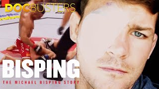 Bisping The Michael Bisping Story  Bispings Retinal Detachment After Fight Against Vitor Belfort [upl. by Herzel]