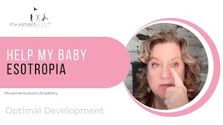 Atypical Development Baby  Esotropia and developmental delays  How do I help my child [upl. by Greerson125]