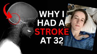 What having a stroke actually felt like [upl. by Wistrup]