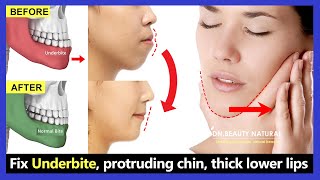 5 Exercises Fix Underbite without surgery fix protruding chin reduce thick lower lip [upl. by Allac]