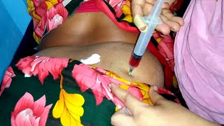 ivf buttock injection video Neuralgin Intramuscular injection buttock injection push 24 Ep 36 [upl. by Juxon]