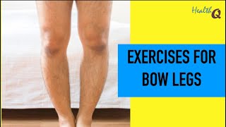 Easy Exercises for bow legs [upl. by Sirenay258]