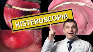 Histeroscopia [upl. by Haimes]