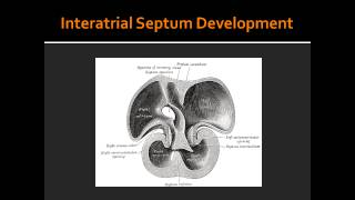 Interatrial Septum Development [upl. by Fowkes750]