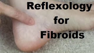 Reflexology for Fibroids  Massage Monday 274 [upl. by Drawd]