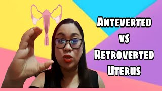 Anteverted vs Retroverted Uterus  Micah [upl. by Lathrope]