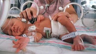 NICU Baby Sucking lips 👄 nicu nicubaby NICU Care Newborn Baby 👶 [upl. by Germain]