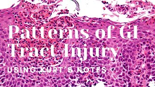 Patterns of GI Tract Injury Kurt’s Notes pathagonia [upl. by Sheena475]