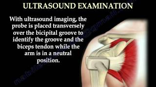 Anatomy Of The Subscapularis Muscle  Everything You Need To Know  Dr Nabil Ebraheim [upl. by Goober]