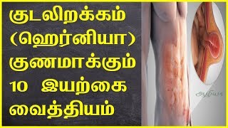 10 Hernia Treatment in Tamil  ஹெர்னியா  குடலிறக்கம்  Kudalerakkam  Hernia in Tamil [upl. by Raynard]