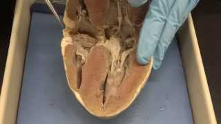 Cardiovascular system Part 3a  Heart dissection [upl. by Yrrej903]