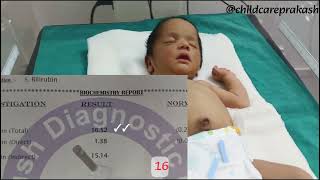 नवजात शिशुओं में पीलियाjaundice in newborn baby [upl. by Ehtiaf]