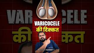 Varicocele Surgery varicocelekailaj [upl. by Yelrahc360]