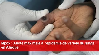 Mpox  Alerte maximale à l’épidémie de variole du singe en Afrique [upl. by Gale]