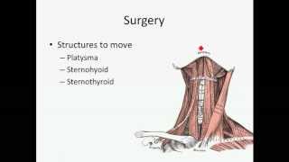 Thyroid Nodules  USMLE Step 2 Review [upl. by Ardek]