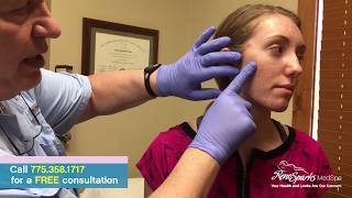 Acne Cyst Drainage Surgery for Cystic Acne  Reno Sparks MedSpa  Dr Calvin Van Reken [upl. by Enelrihs579]