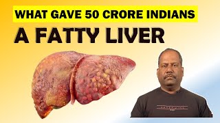 What gave 50 Crore Indians Fatty Liver  What You Should Do  Fatty Liver [upl. by Talbot538]