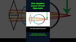 How lenses correct Hyperopia [upl. by Iruahs]