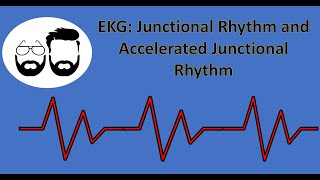 EKG Series Junctional Rhythm Accelerated Junctional Rhythm and Junctional Tachycardia [upl. by Adnawuj]