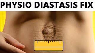 Heal Diastasis Recti FAST – Physiotherapy Guide to FIX amp FLATTEN your BELLY [upl. by Eisaj]