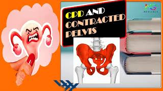 Cephalo Pelvic Disproportion and Contracted Pelvis  Full Explanation in Hindi  By NG Medicals [upl. by Chaunce]