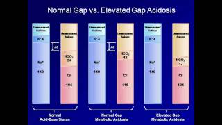 ABG Interpretation The Anion Gap Lesson 5 [upl. by Adniroc]