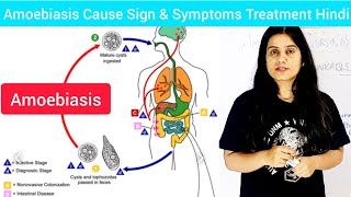 Amoebiasis Cause Symptoms Treatment in Hindi  What is Amoebiasis in Hindi  Entamoeba histolytica [upl. by Retsbew]