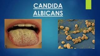 CANDIDA ALBICANS  TEMA 4 [upl. by Sarat671]