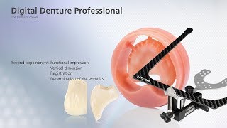 Digital Denture – second Appointment [upl. by Eceinwahs585]