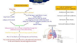 Atelectasis Respiratory Physiology Chapter 43 part 4 Guyton and Hall Physiology [upl. by Doralyn]