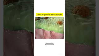 saline irrigation in nasal Allergies anatomy 3Dstructure biology pharmacy shorts viral nasal [upl. by Kelby]