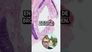 Bronchus Histologie van een Bronchus [upl. by Ignatzia]