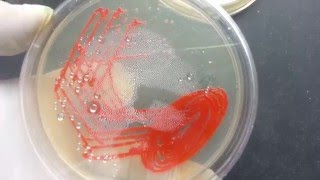 Serratia marcescens pigment expressionrhodopsin [upl. by Otto665]