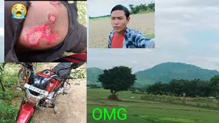 OMG V15 Bike accident crash  Bikram Vlogs 🙏😭😭😭😭😭 [upl. by Debarath]