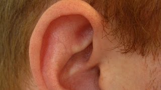 Determine If Ear Cartilage Is Infected  Ear Problems [upl. by At]