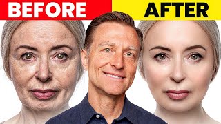 The Ultimate Face Transformation–Dr Bergs Best Remedy for Dry Skin and Wrinkles [upl. by Eatnod]