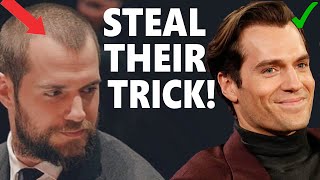 Top 5 Actors Who Are Receding Hairline Masters Steal their 4 key tricks [upl. by Selegna136]