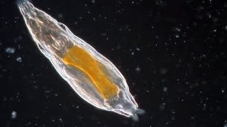 Bdelloid Rotifers so common yet so weird [upl. by Aisayt]