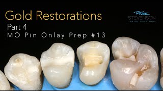 Cast Gold Restorations Part 4 MO Pin Onlay Preparation 13 [upl. by Sokil414]