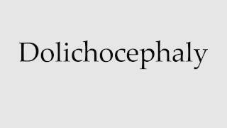 How to Pronounce Dolichocephaly [upl. by Terrag883]