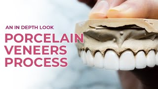 Porcelain Veneers A Dental Boutique Process  An In Depth Look [upl. by Neeliak186]