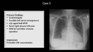 How to Interpret a Chest XRay Lesson 10  Self Assessment Part 1 [upl. by Ellednahc]