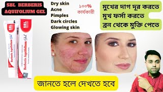 Best Acne Pimple Cream ।। SBL Berberis Aquifolium Gel Benefits ।। Review in Bengali [upl. by Nyladnarb]