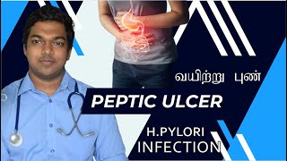 Peptic ulcer explained in Tamil  வயிற்று புண் HPylori Infection [upl. by Adnilg]