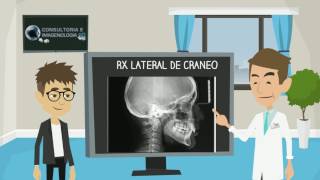 Rx Lateral de Craneo [upl. by Goggin]