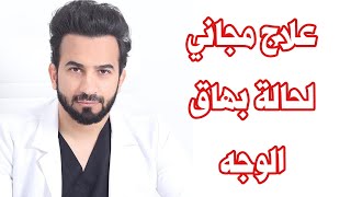 علاج مجاني لحالة البهاق في الوجه [upl. by Jasmine869]